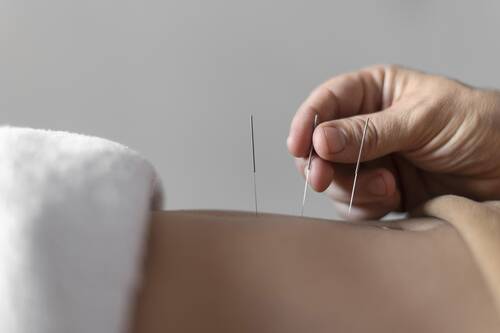 Close up hand holding acupuncture needle